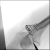 SPORK, NICO - 22.03.1976 - 04.08.2022 - Durchleuchtung UN OP - 10:59:22